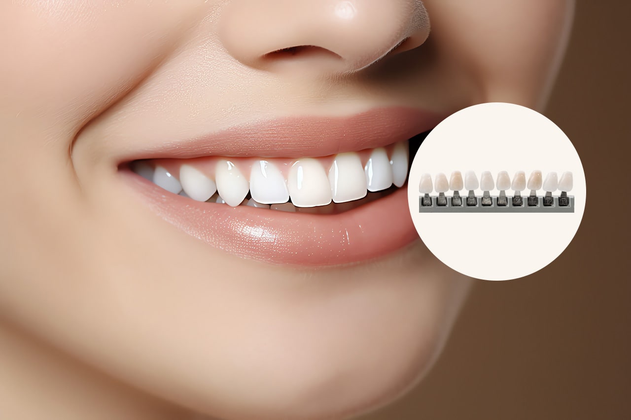 ΑΙΣΘΗΤΙΚΗ ΟΔΟΝΤΙΑΤΡΙΚΗ