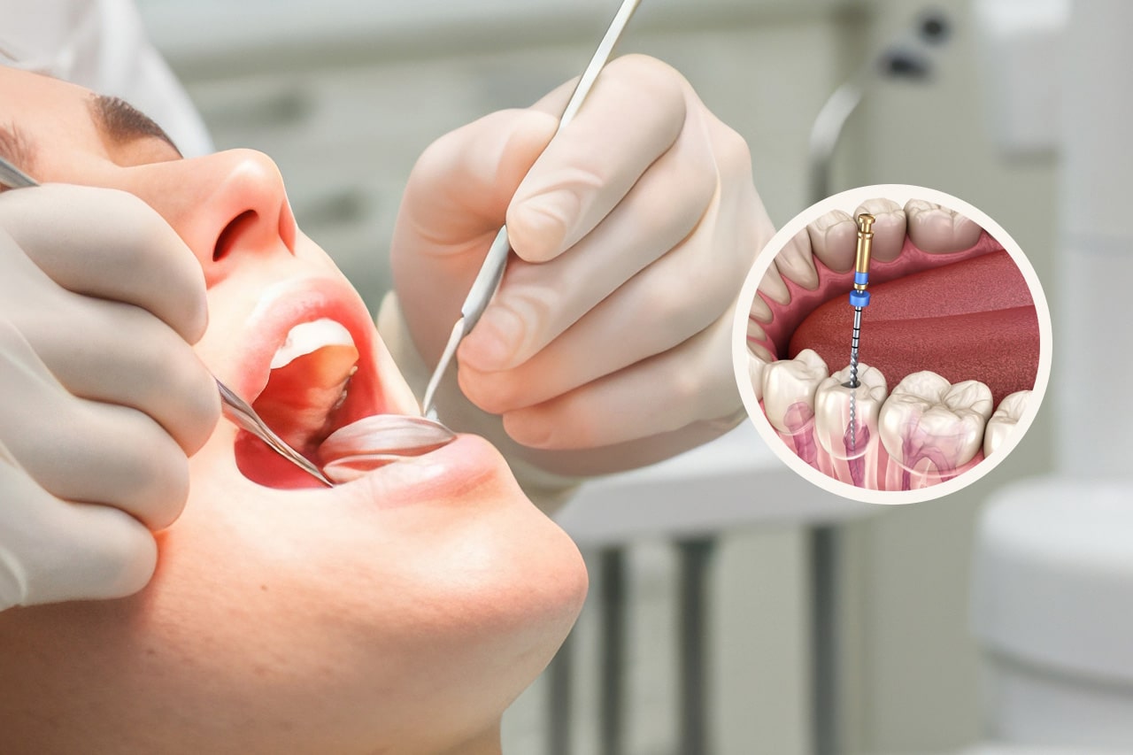 ΕΝΔΟΔΟΝΤΙΑ