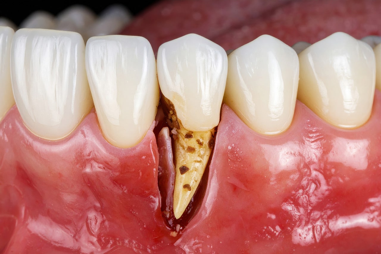 Περιοδοντολογία